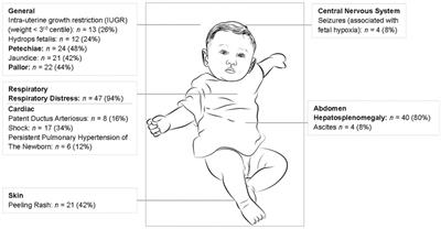 Placental weights of neonates born with symptomatic congenital syphilis